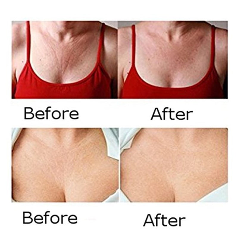 HomeAura Overnight Smoothing Patches — Reusable Silicone
